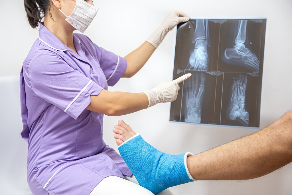 What Are The Different Types Of Fractures And Their Treatment Options