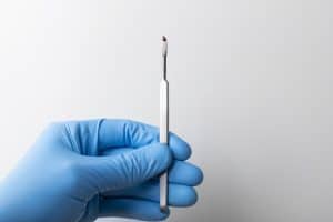 Needle Arthroscopy: A Minimally Invasive Approach to Joint Health