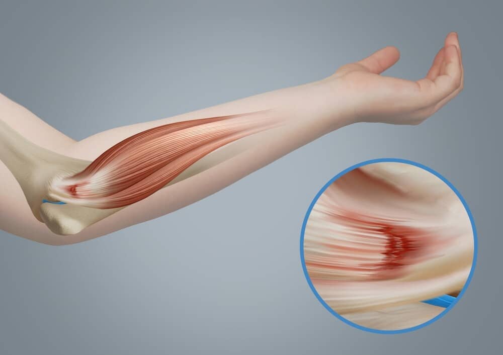 how the elbow functions during daily activities.