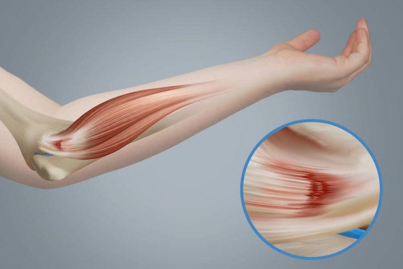 how the elbow functions during daily activities.